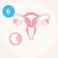 Step 6